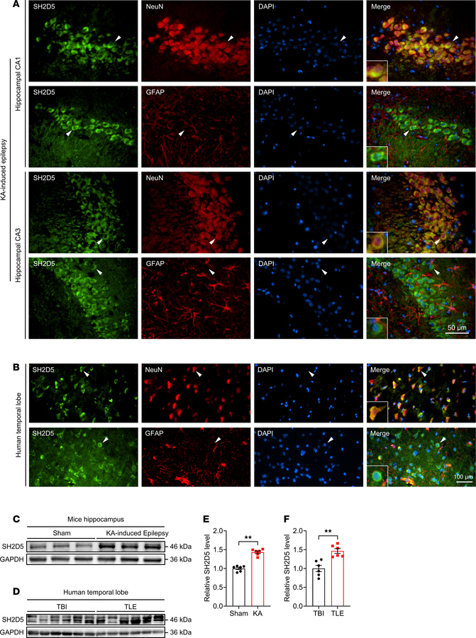 Distribution and expression of SH2D5 in epileptic brain tissues.
(A) Rep...