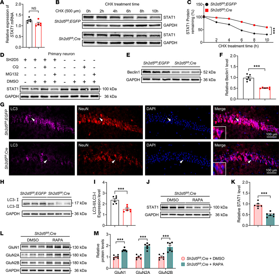 SH2D5-mediated autophagy modulates the expression of STAT1.
(A) Quantifi...