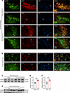 Distribution and expression of SH2D5 in epileptic brain tissues.