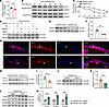 SH2D5-mediated autophagy modulates the expression of STAT1.