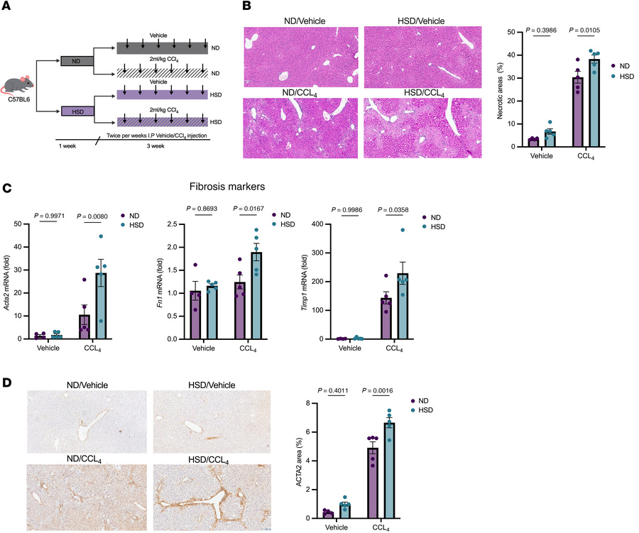 High salt diet exacerbates liver fibrosis in a mouse model of CCl4-induc...