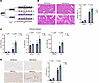 High salt diet exacerbates liver fibrosis in a mouse model of CCl4-induced