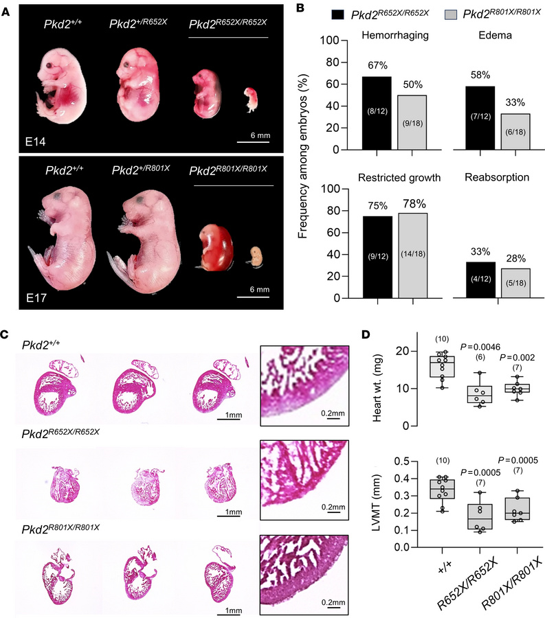 Mice expressing homozygous PKD2 truncation variant alleles are embryonic...