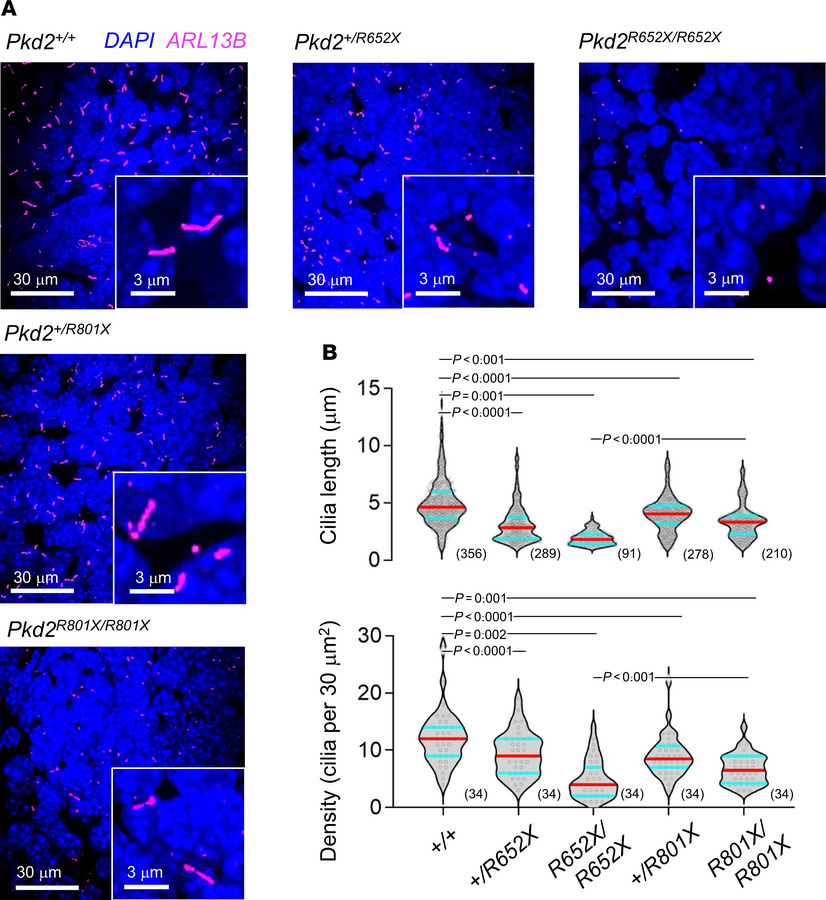 Truncation variants attenuate cilia length in vivo.
(A) Immunohistochemi...