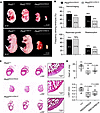 Mice expressing homozygous PKD2 truncation variant alleles are embryonic le