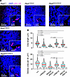 Truncation variants attenuate cilia length in vivo.