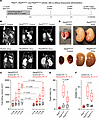 Compound transgenic mice expressing analogous PKD2 truncating variants have