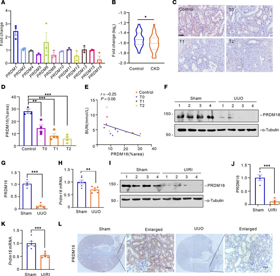 PRDM16 was decreased in the injured kidneys of mice and humans.
(A) Fold...