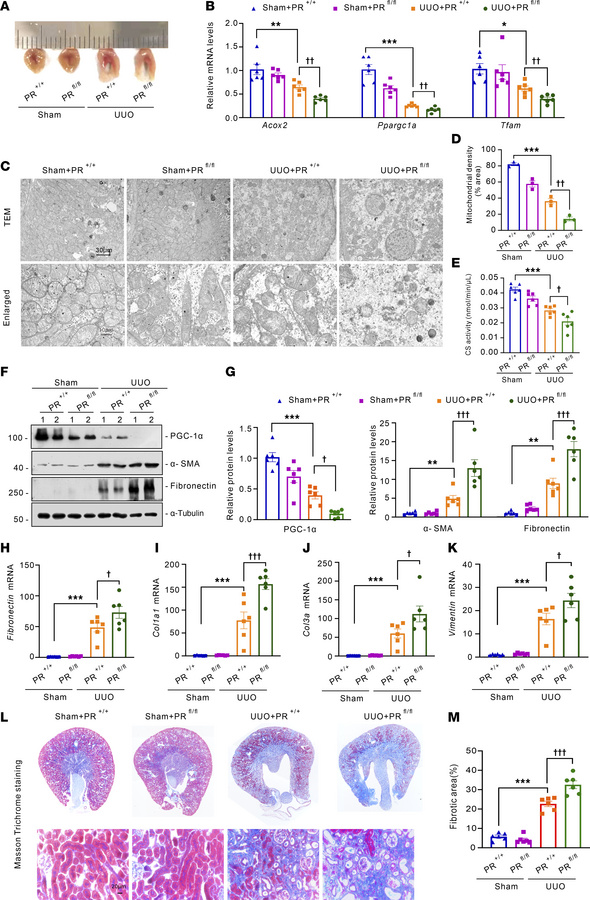 Tubular-specific knockout Prdm16 promoted tubular mitochondrial injury a...