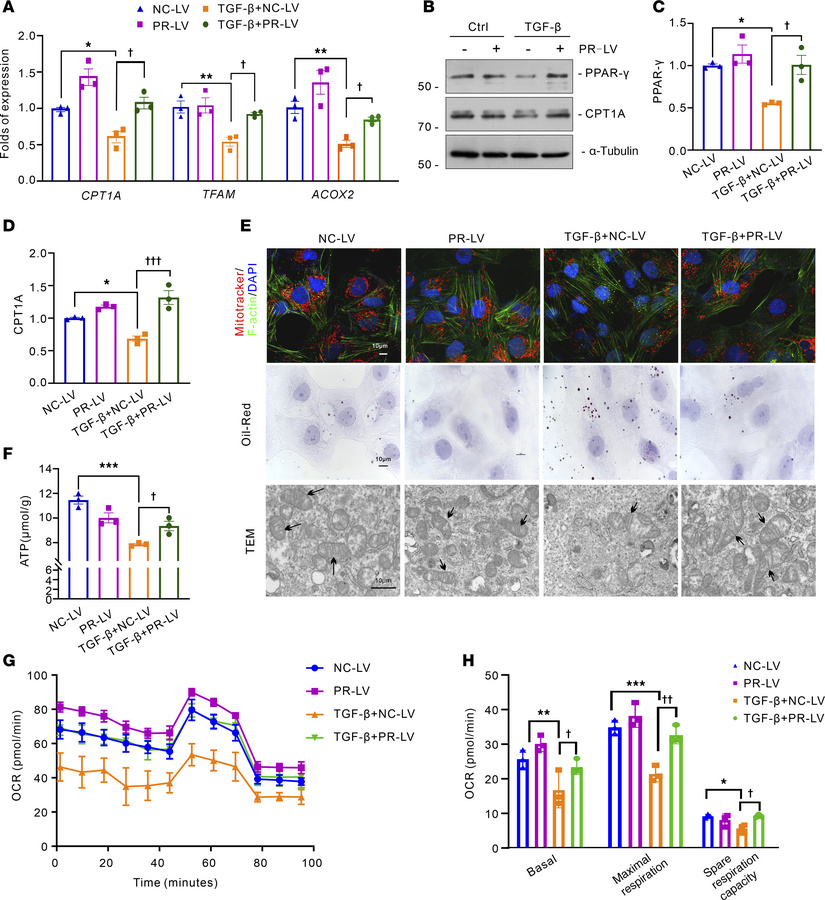 PRDM16 inhibited TGF-β induced tubular mitochondrial dysfunction and TGF...