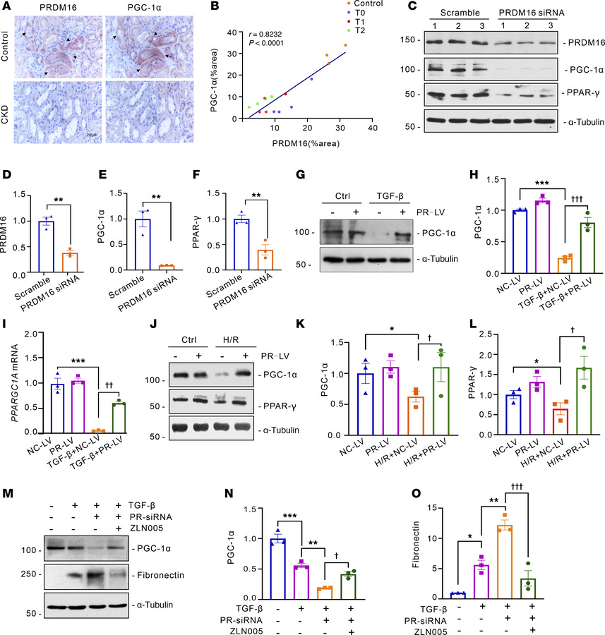 PRDM16 rescued tubular mitochondrial function via upregulating PGC-1α.
(...