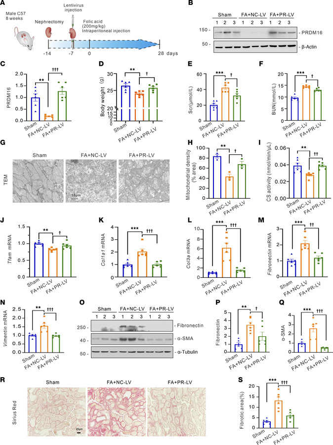 Renal PRDM16 lentivirus injection attenuated folic acid–induced mitochon...