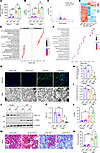 Tubular-specific knockout Prdm16 aggravated ischemia-reperfusion–induced re