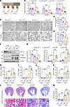 Tubular-specific knockout Prdm16 promoted tubular mitochondrial injury and