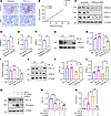 PRDM16 rescued tubular mitochondrial function via upregulating PGC-1α.