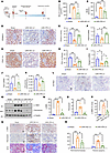 Renal injection with PRDM16 overexpressing lentivirus attenuated mitochondr