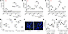 Combinatorial strategies to enhance PUFA-mediated cytotoxicity in GBM.