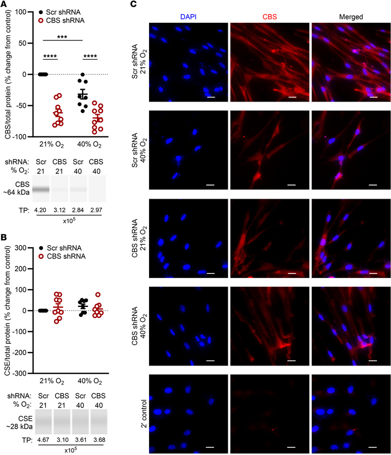 Generation of CBS stable KD in fASM cells using lentiviral particles.
Le...