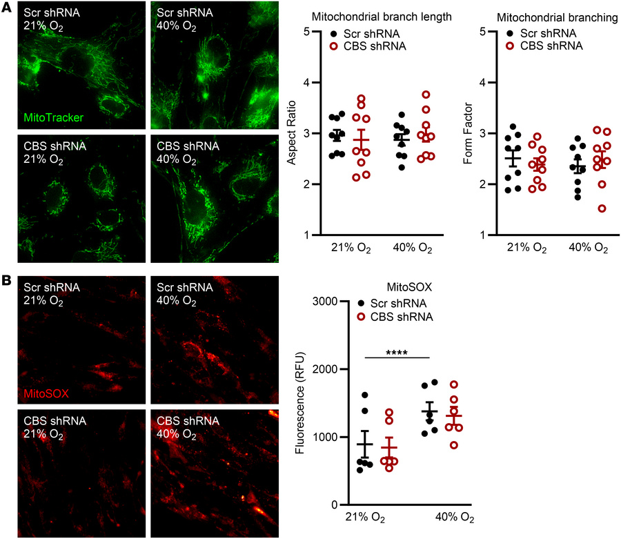 CBS KD alters mitochondrial morphology and ROS in fASM cells exposed to ...