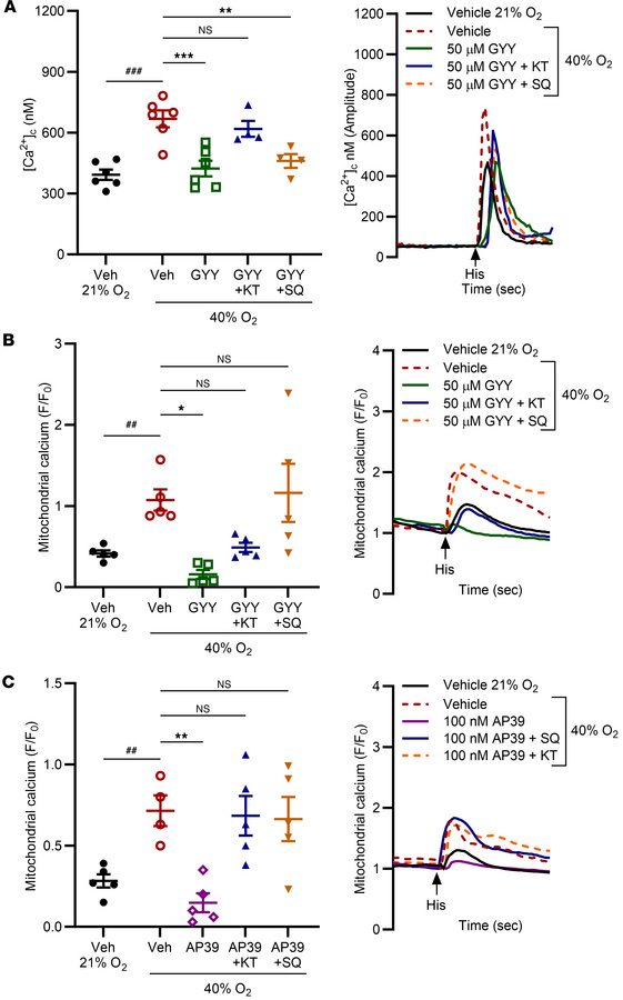 H2S attenuates O2 effects on calcium through the cAMP pathway.
(A and B)...