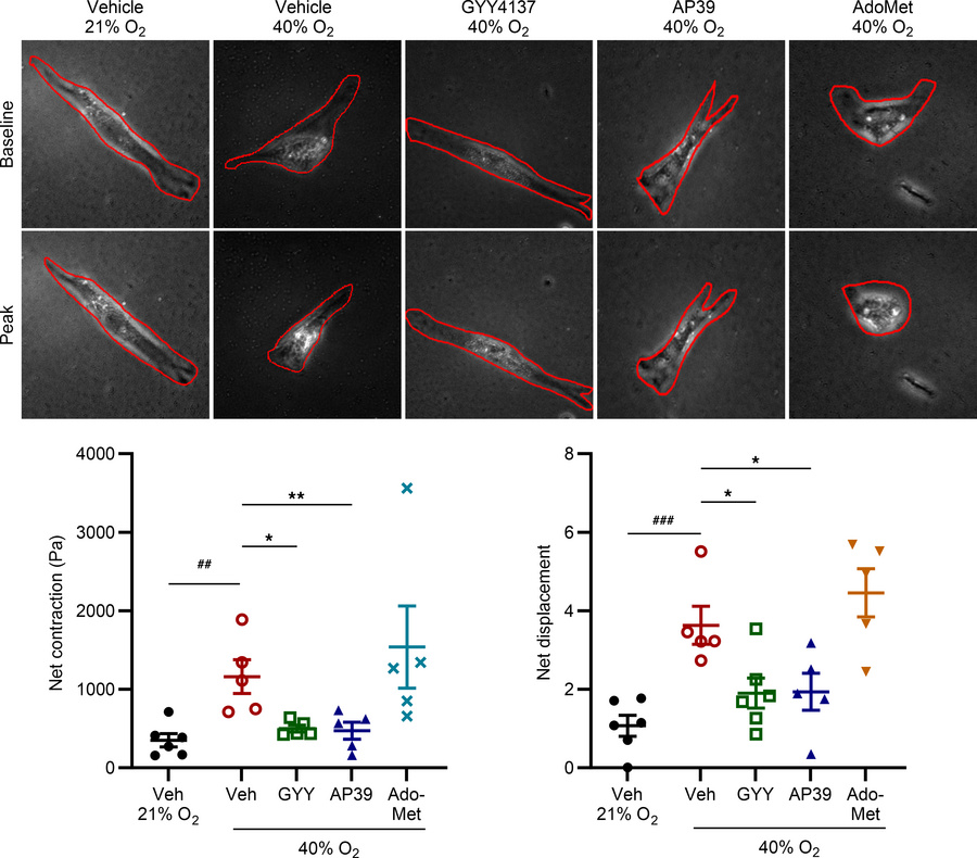 Exogenous H2S donors attenuate O2 effects on fASM cell contractility.
Hy...