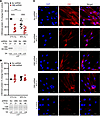 Generation of CBS stable KD in fASM cells using lentiviral particles.