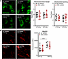 CBS KD alters mitochondrial morphology and ROS in fASM cells exposed to mod