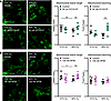 Exogenous H2S donors attenuate O2-induced mitochondrial dysfunction.