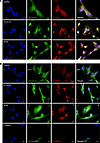 H2S donors increase p-CREB expression.