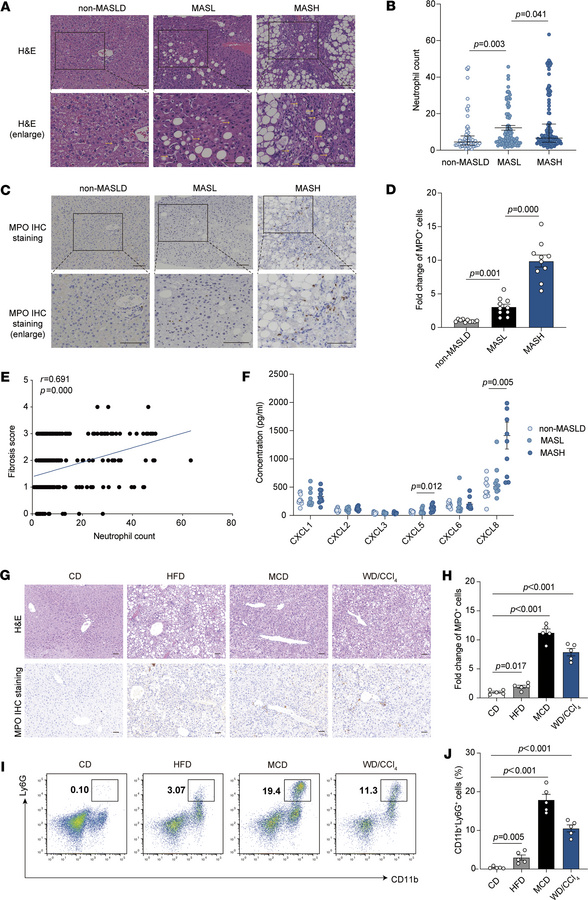 The presence of neutrophils in fatty liver tissue is proportionally link...