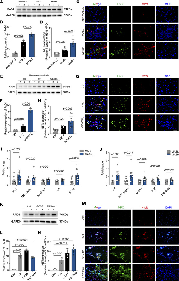 Inflammatory cytokines in MASH livers promote increased expression of PA...