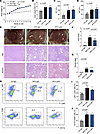 Effects of neutrophil depletion on liver under HFD model.