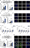 Inflammatory cytokines in MASH livers promote increased expression of PAD4+
