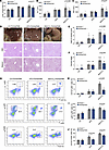 Effects of inhibiting PAD4+ neutrophil and NET formation on liver under CD,
