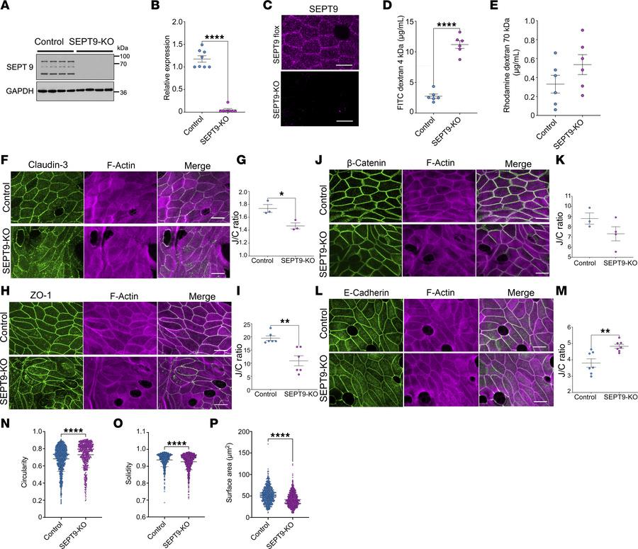 SEPT9 deletion in intestinal epithelium increases permeability and disru...