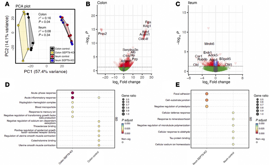 Loss of SEPT9 induces transcription reprogramming of intestinal epitheli...
