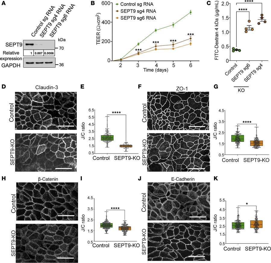 SEPT9 knockdown in model intestinal epithelial monolayers disrupts barri...