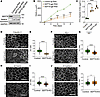 SEPT9 knockdown in model intestinal epithelial monolayers disrupts barrier