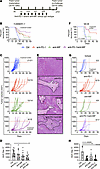 Anti–PD-1/anti-MIF improves survival and tumor responses.