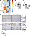 Dual inhibition of PD-1 and MIF enhances cytokines/chemokines associated wi