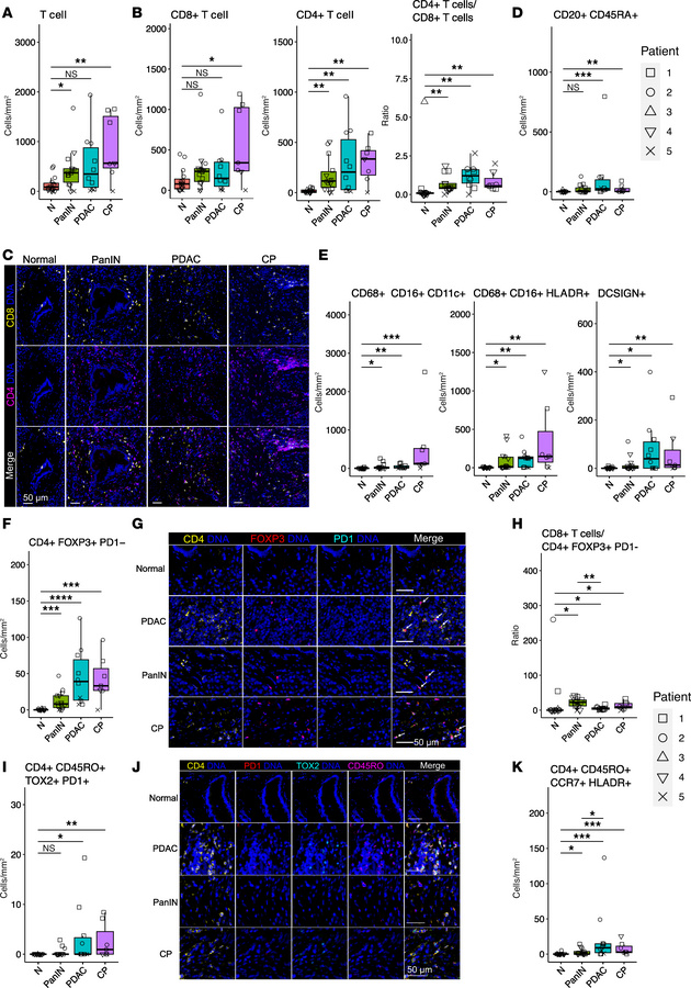 PanINs exhibit reduced exhausted and Treg populations relative to region...