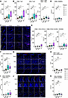 PanINs exhibit reduced exhausted and Treg populations relative to regions o