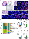 Tertiary lymphoid structures (TLSs) associated with PanINs maintain an imma