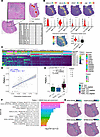 10× Genomics Visium spatial transcriptomics platform recapitulates TLS sign