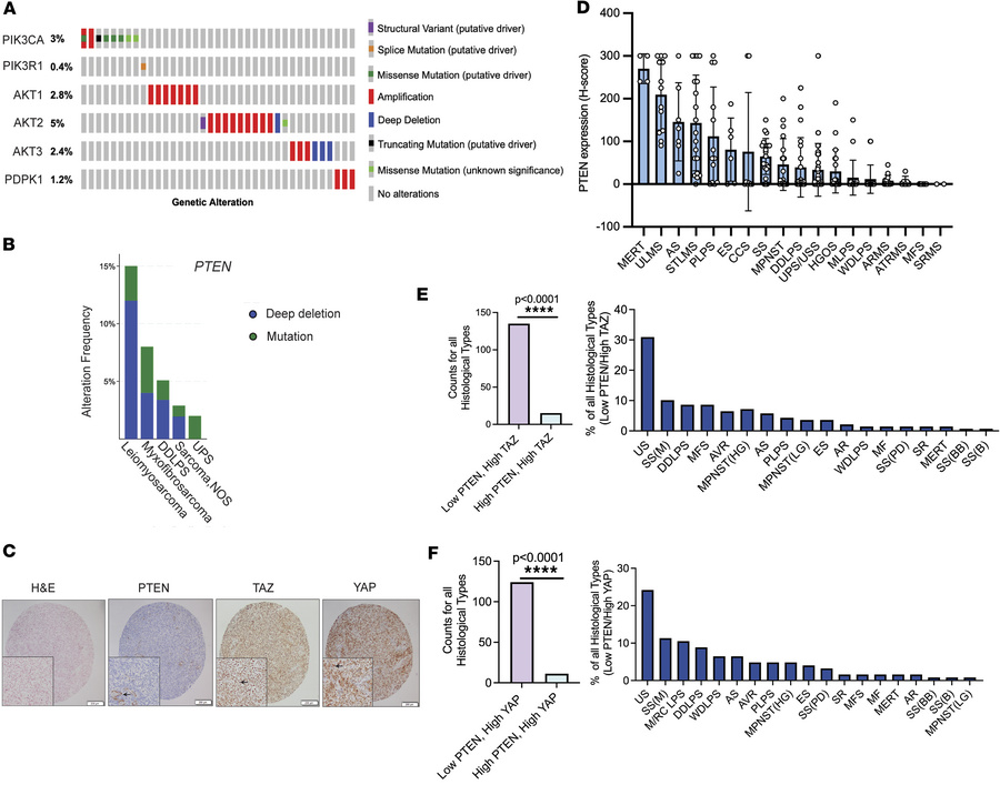 PI3K is widely activated in sarcomas.
(A) The Cancer Genome Atlas (TCGA)...