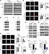 PI3K inhibition alters the stability and localization of TAZ/YAP in SJCRH30