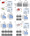 Pharmacological inhibition of YAP/TAZ and mTORC1 works synergistically in v