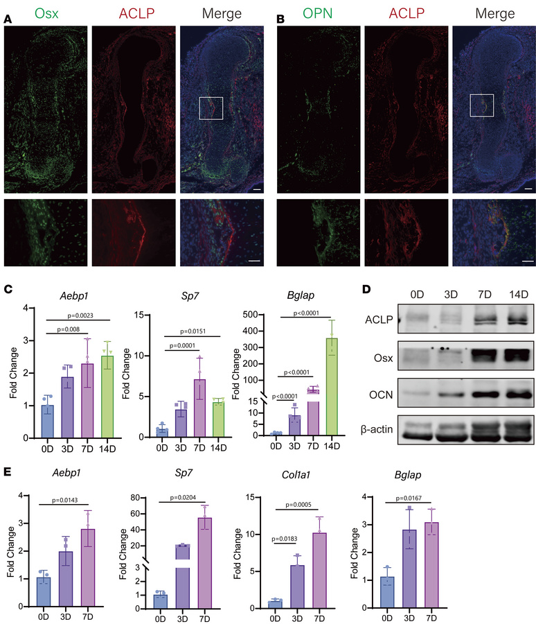Characterization of ACLP in the developing long bones.
(A) Representativ...