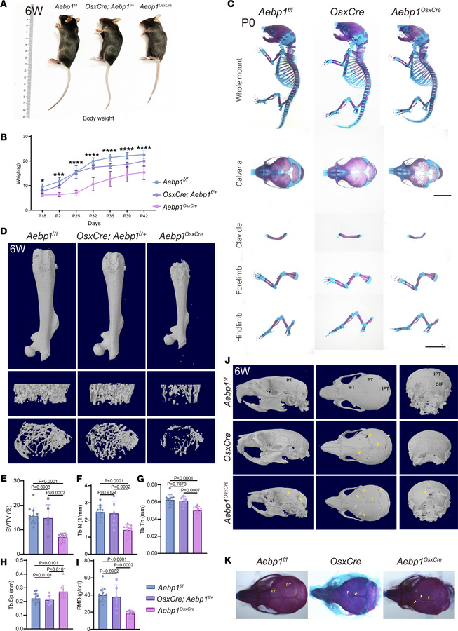 Deletion of Aebp1 in osteoprogenitor cells induced skeletal defects.
(A)...