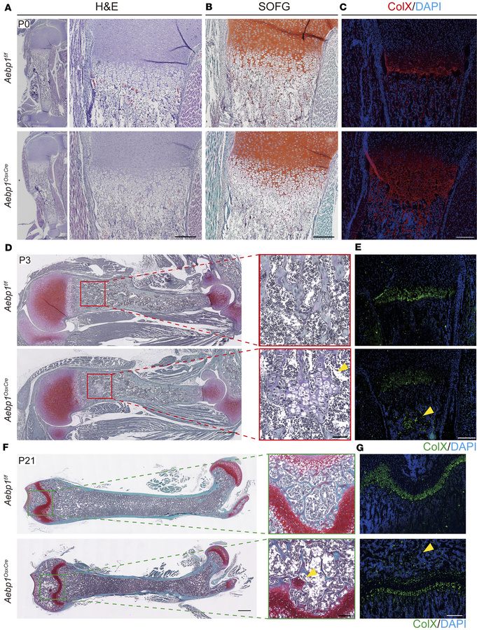 Loss of Aebp1 in osteoprogenitor cells delayed endochondral ossification...